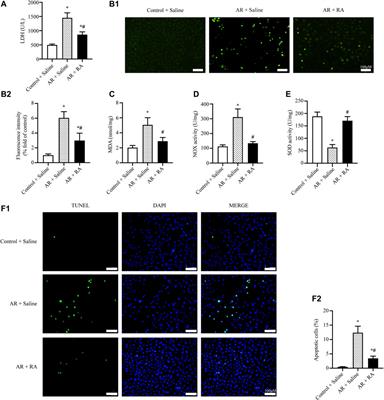 Rosmarinic Acid Ameliorates Pulmonary Ischemia/Reperfusion Injury by Activating the PI3K/Akt Signaling Pathway